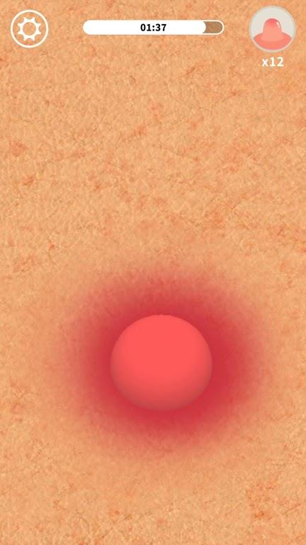 Acne  v1.0.1图2