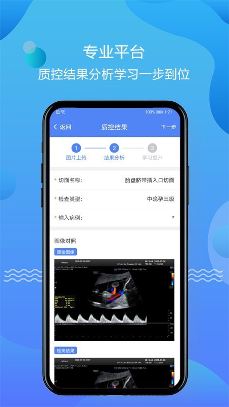 超声智库  v1.0.8图2